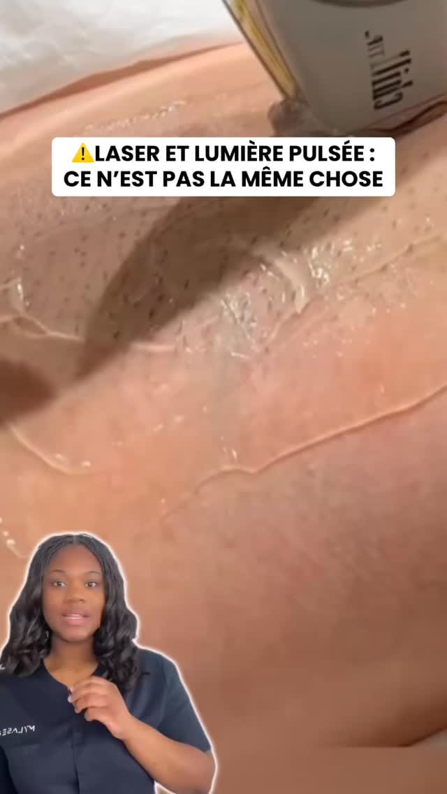 Post 8 by My Laser Center on Instagram (video)