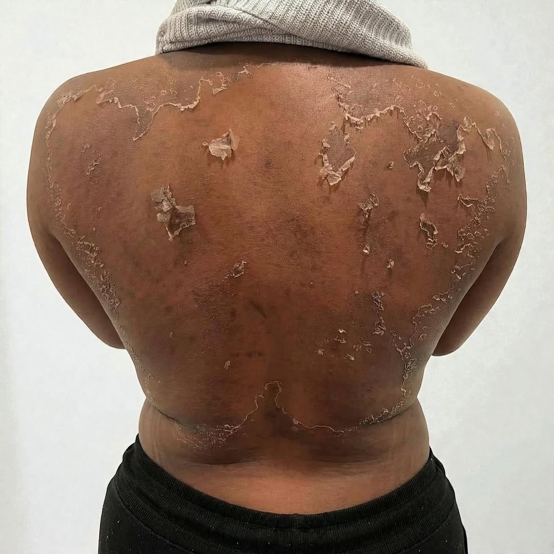 Post 7 by My Laser Center on Instagram (image)