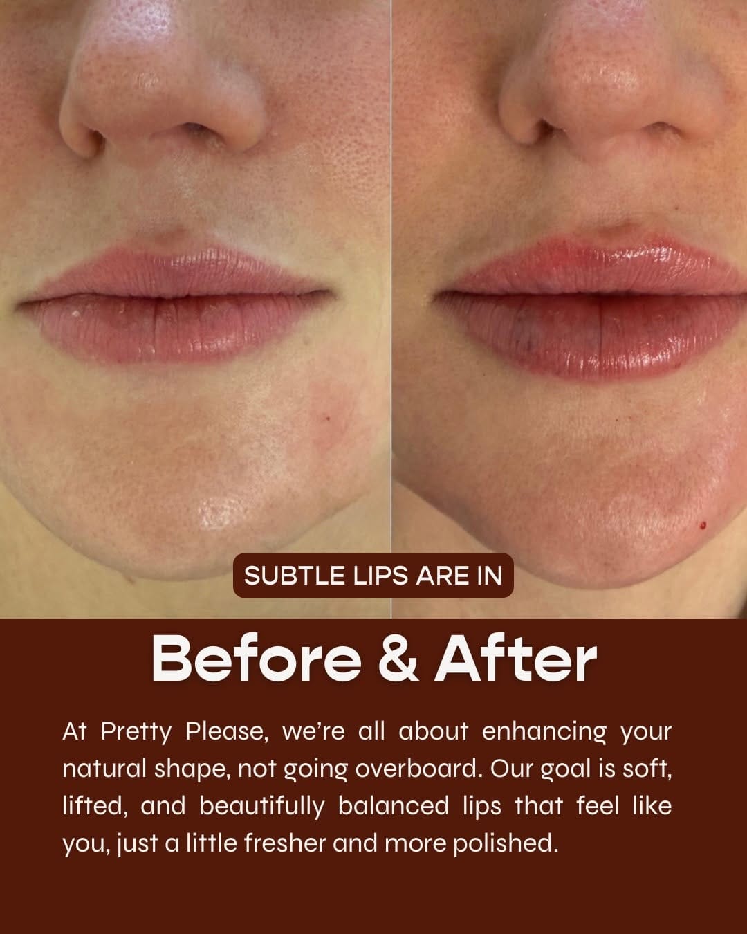 Post 7 by Sacramento Aesthetics Practice on Instagram (carousel)