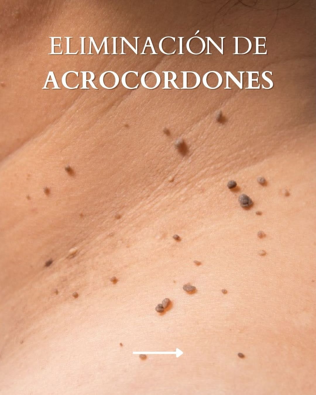 Post 2 by IDERMIC - Dermatología médica y estética on Instagram (carousel)