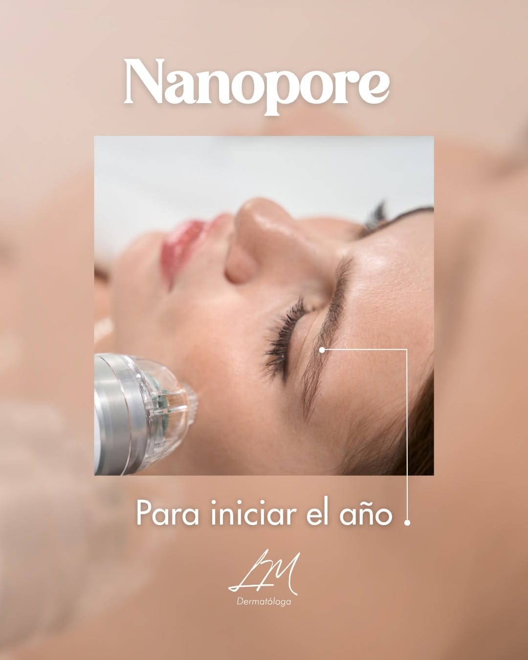 Post 5 by Dermatología | Labios | Botox | Bioestimulador | Peeling on Instagram (image)
