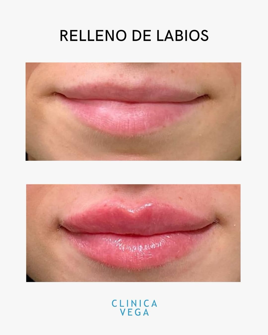 Post 7 by Clínica Medicina Estética on Instagram (image)