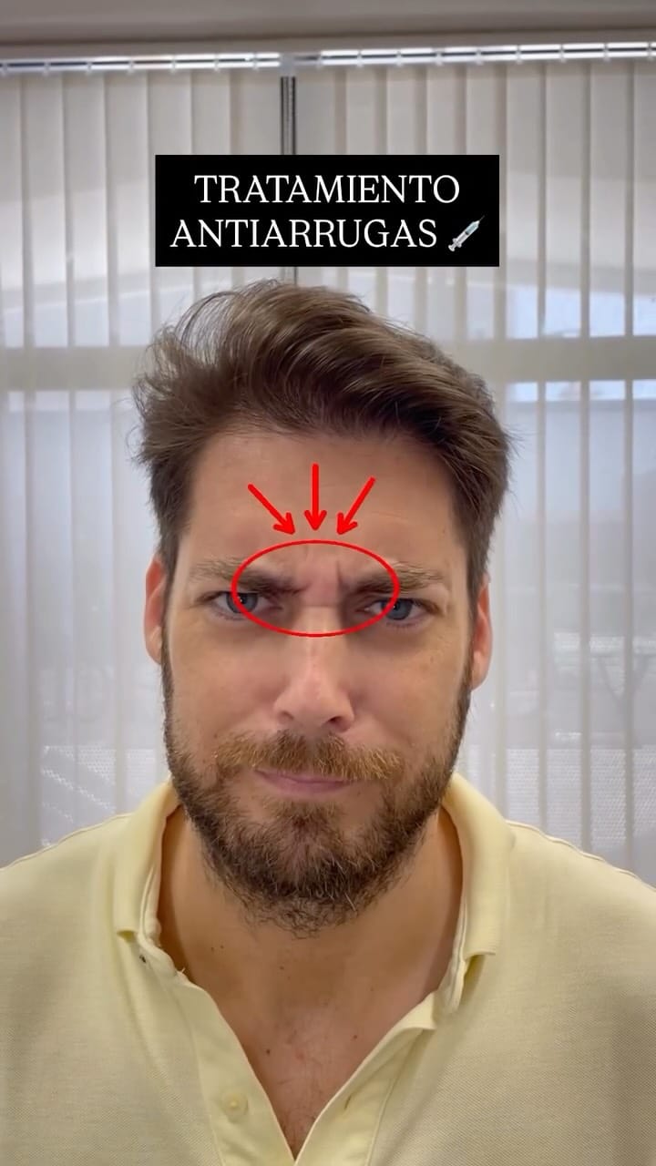Post 10 by Clínica Estética Aesophy | Málaga on Instagram (video)