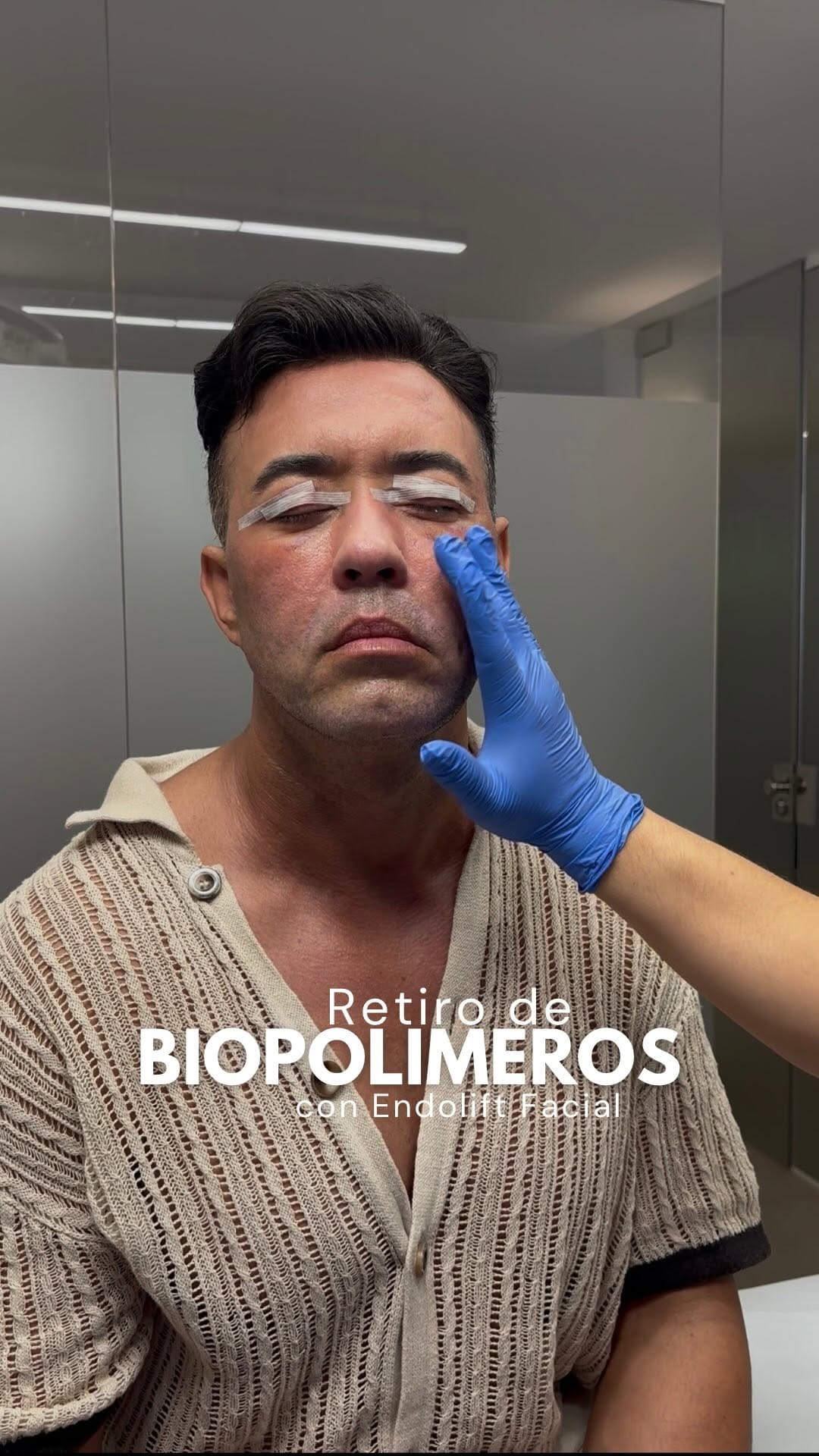 Post 7 by Clínica Estética Aesophy | Málaga on Instagram (video)