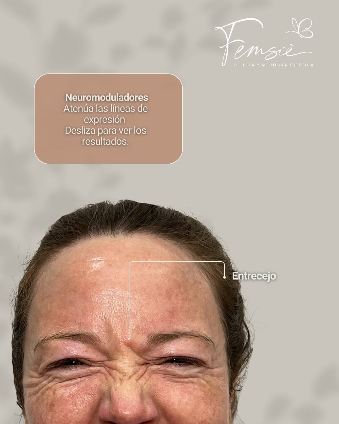 Post 9 by Femsiè. Belleza & Medicina Estética on Instagram (carousel)