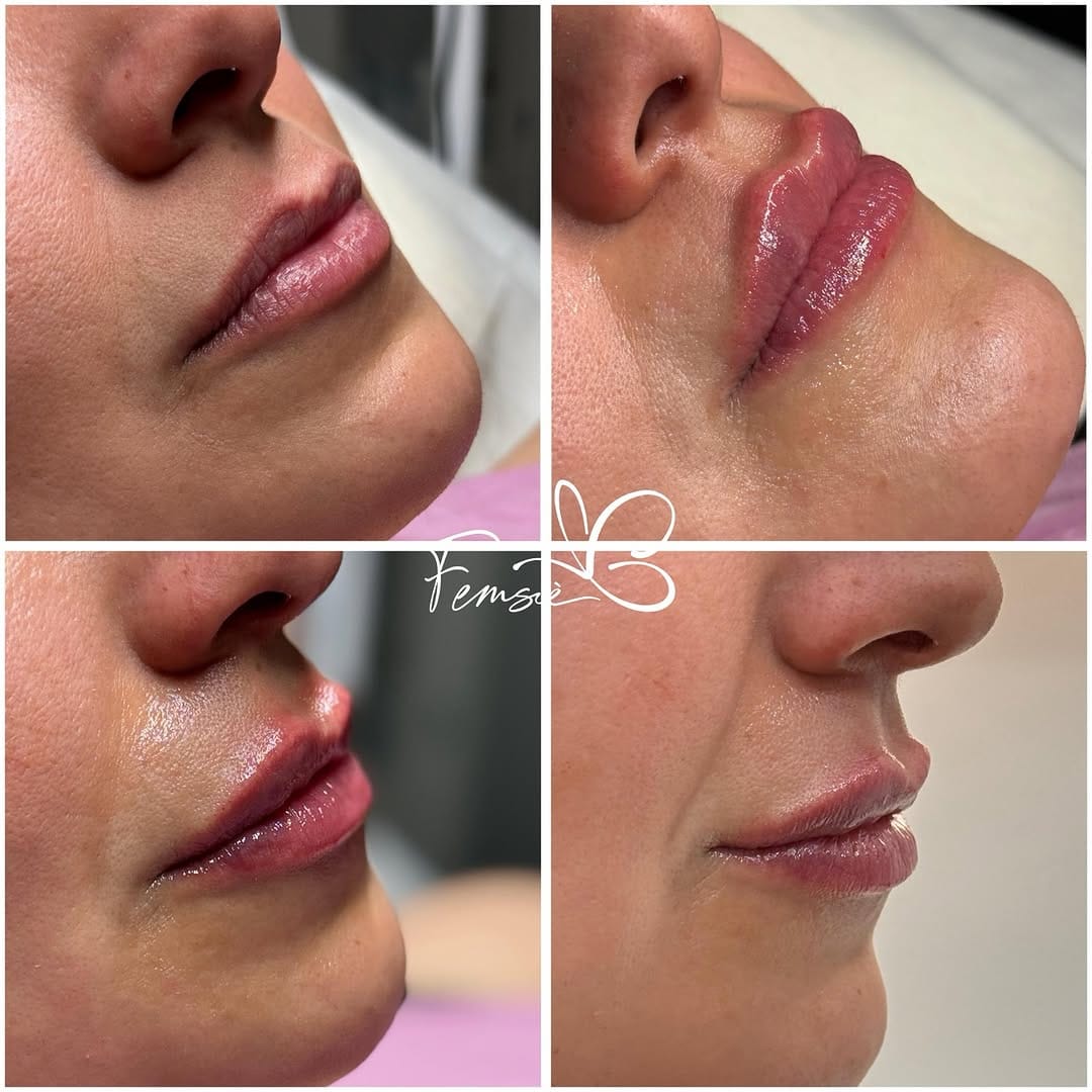 Post 7 by Femsiè. Belleza & Medicina Estética on Instagram (image)