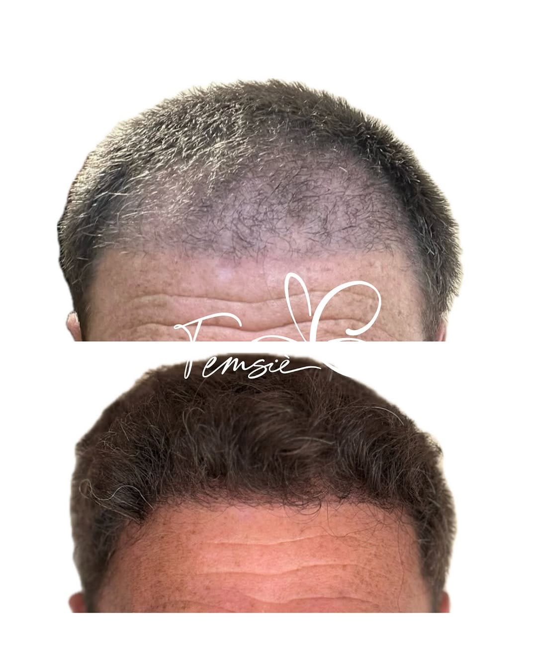 Post 5 by Femsiè. Belleza & Medicina Estética on Instagram (image)