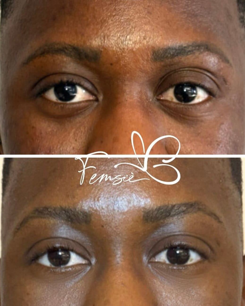 Post 4 by Femsiè. Belleza & Medicina Estética on Instagram (image)