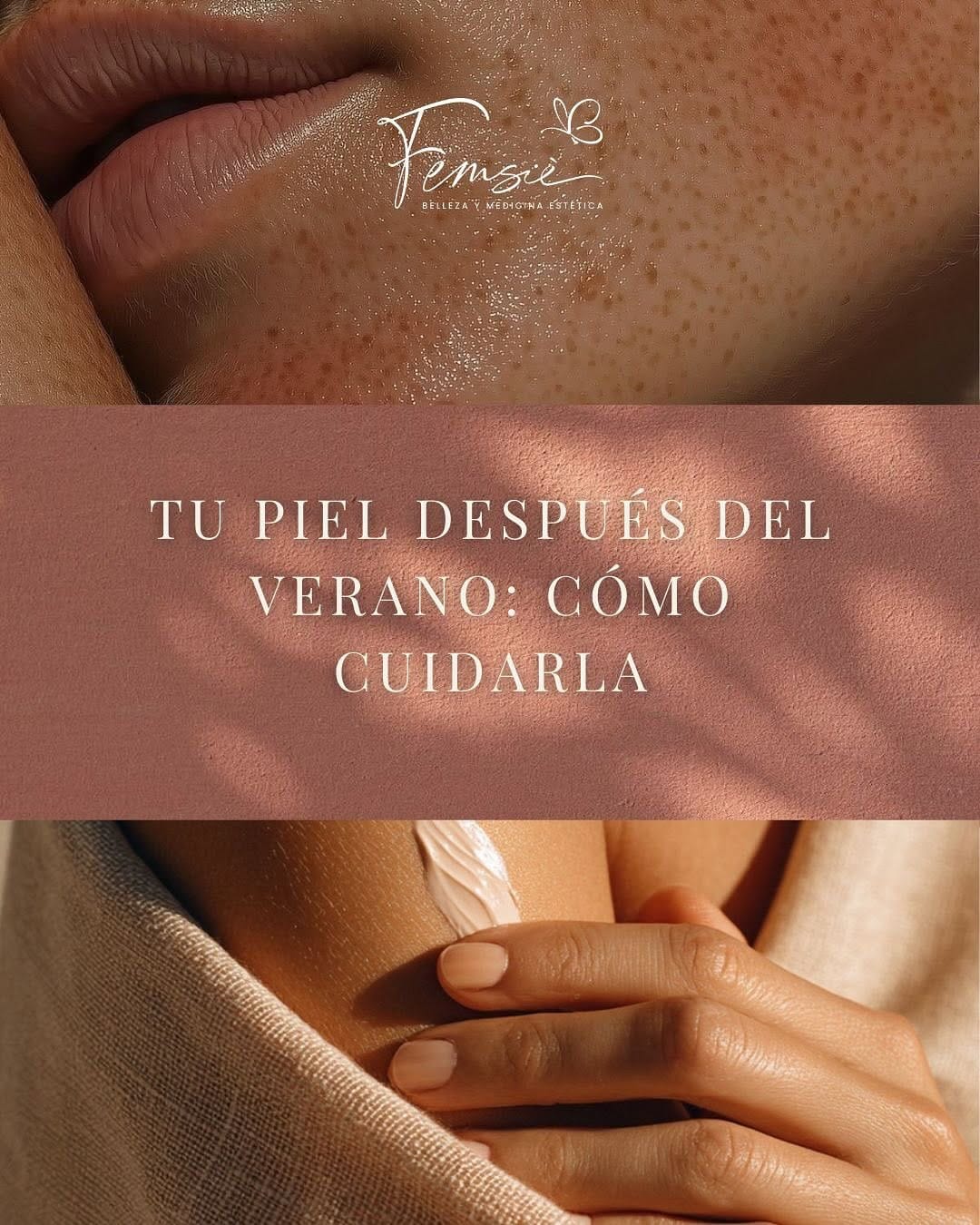 Post 8 by Femsiè. Belleza & Medicina Estética on Instagram (carousel)