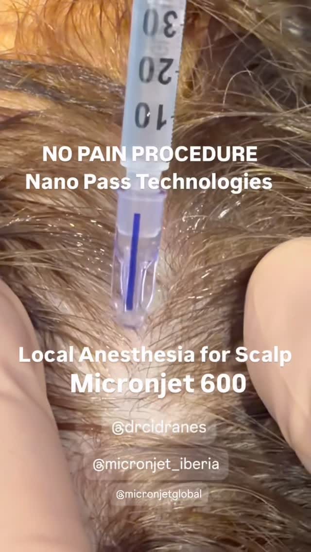 Post 5 by Ernesto Delgado Cidranes on Instagram (video)