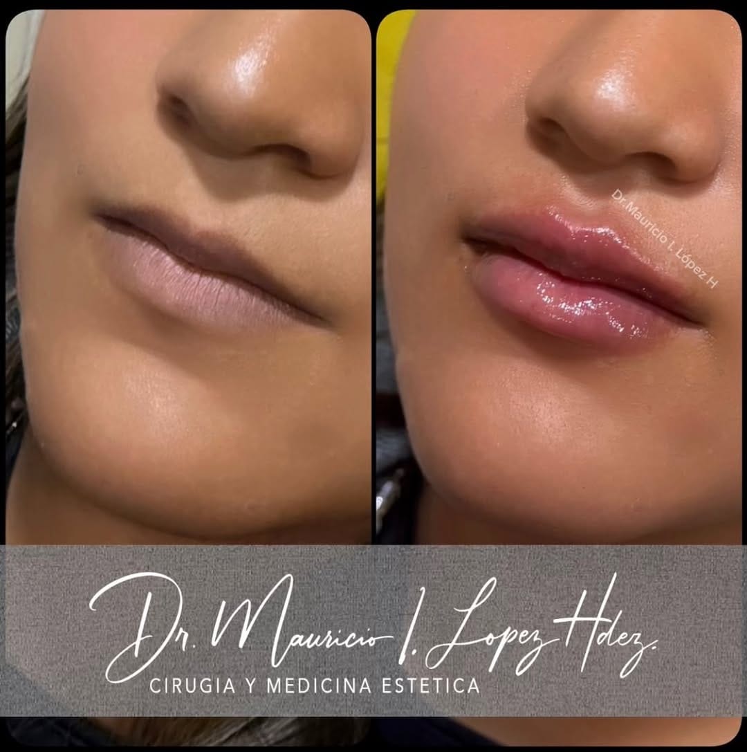 Post 2 by Dr Mauricio Lopez Hernandez on Instagram (image)