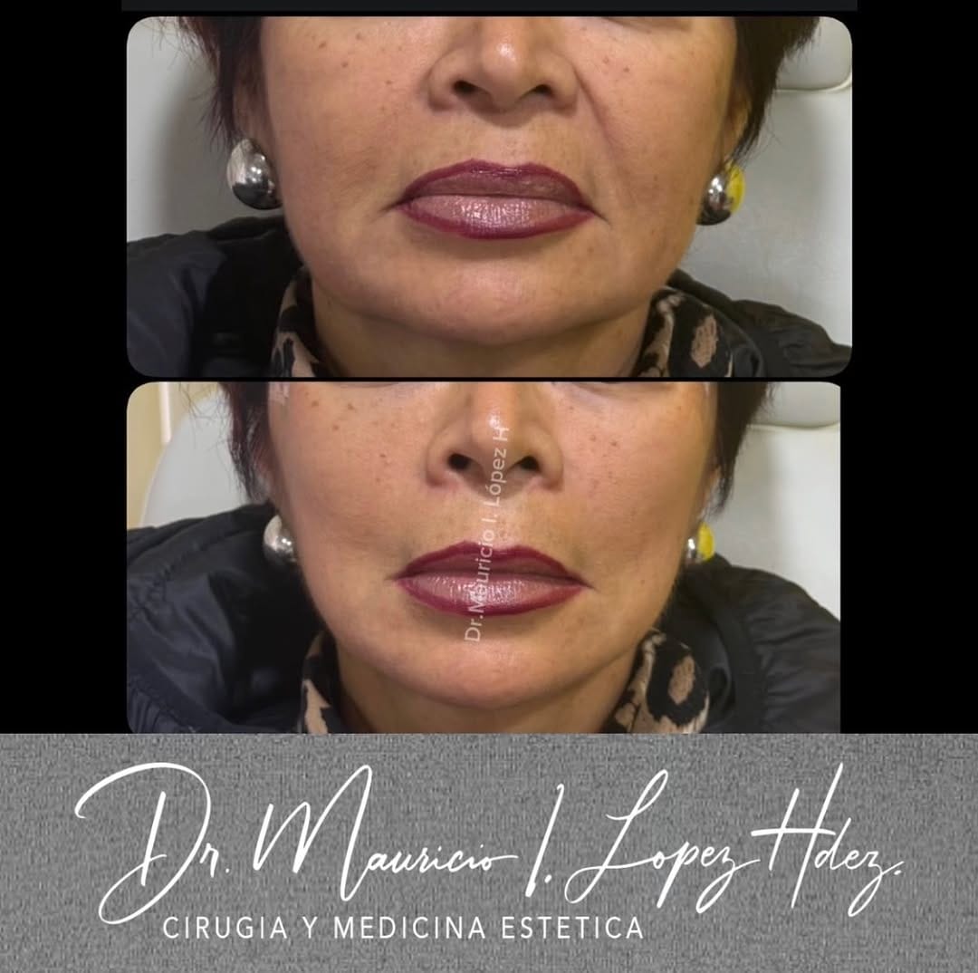 Post 3 by Dr Mauricio Lopez Hernandez on Instagram (image)