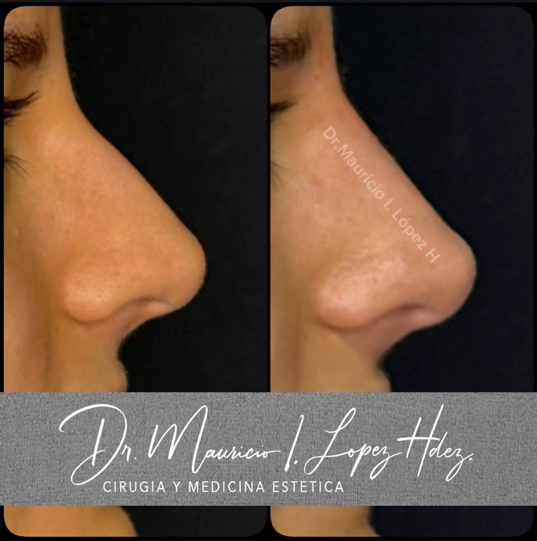 Post 8 by Dr Mauricio Lopez Hernandez on Instagram (image)