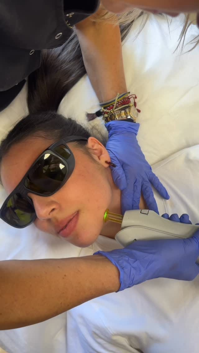 Post 1 by 𝗗𝗘𝗥𝗠𝗘𝗦 on Instagram (video)