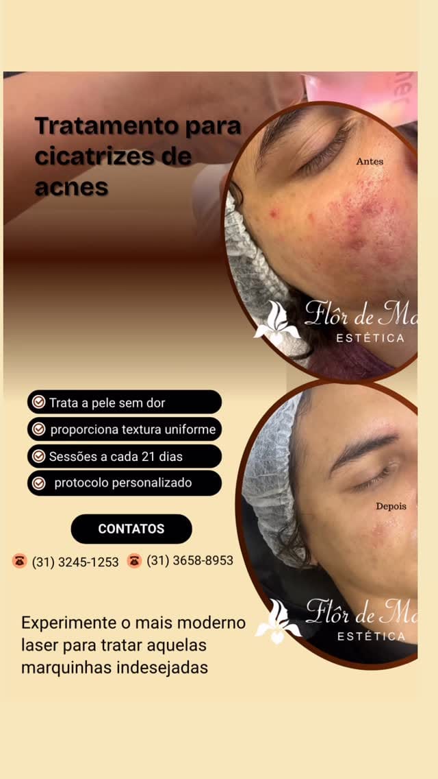 Post 2 by Flôr de Maio Estética on Instagram (video)