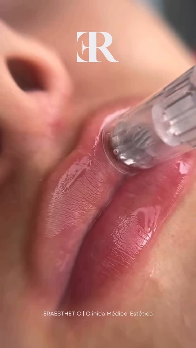 Post 5 by ERAESTHETIC | Clínica Medicina y Estética Avanzada on Instagram (video)