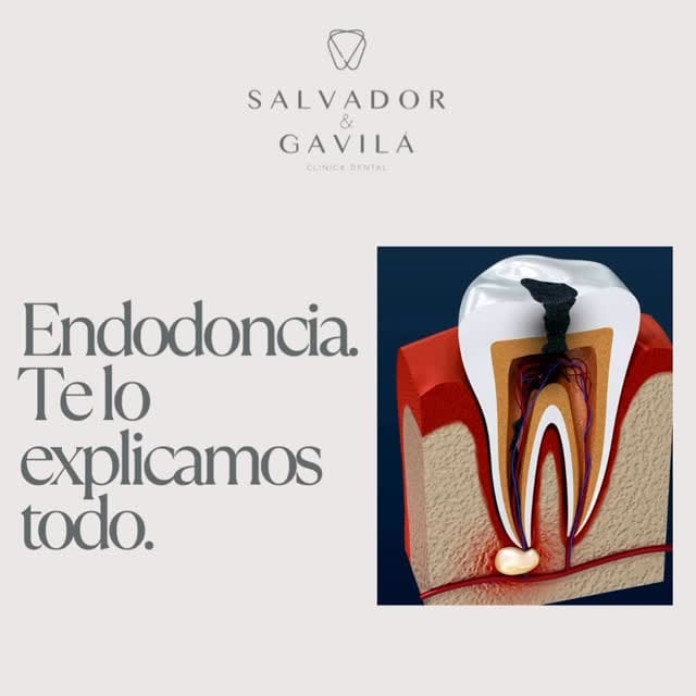 Post 5 by Salvador & Gavilá Dental on Instagram (video)