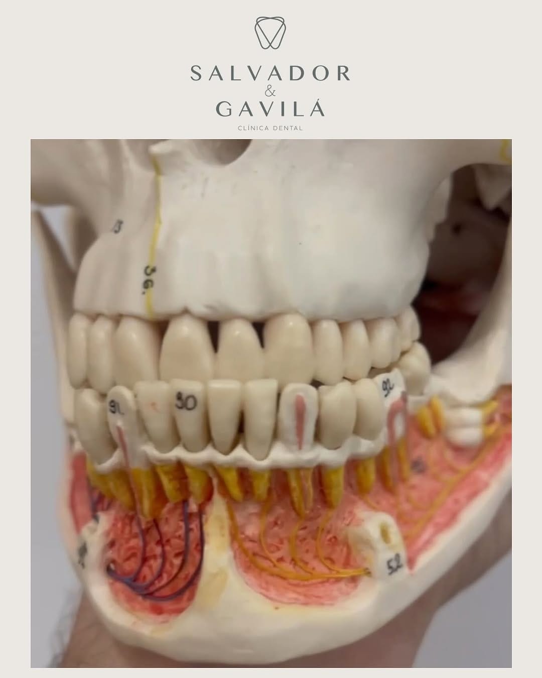 Post 8 by Salvador & Gavilá Dental on Instagram (image)