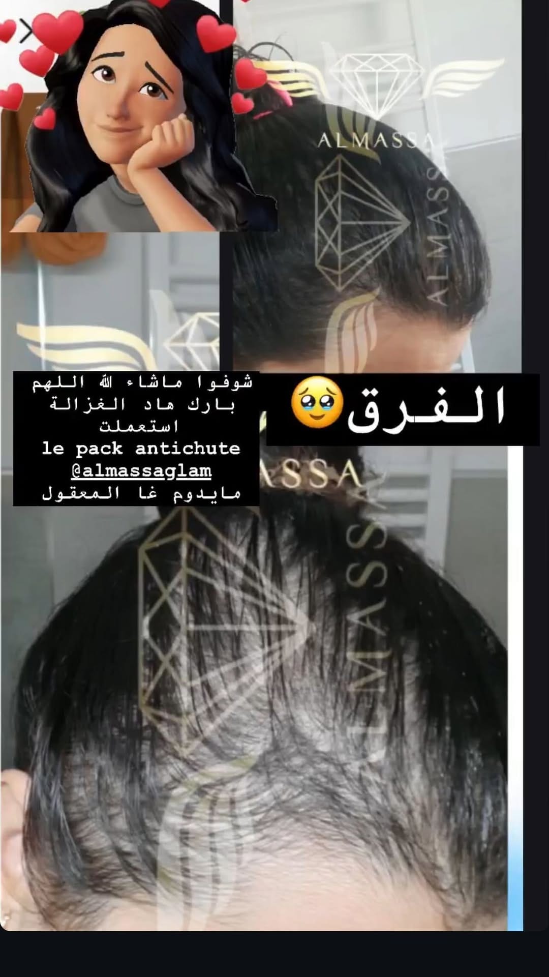 Post 10 by Amina Lokmane🤎Almassa ألماسة on Instagram (video)