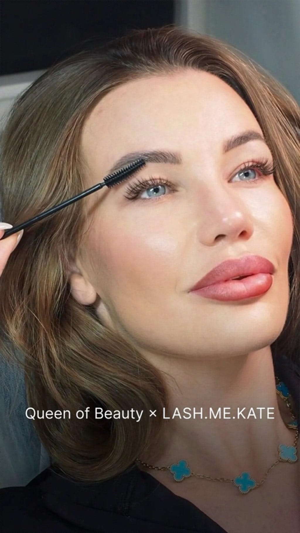 Post 10 by Advanced aesthetic clinics London/Marbella on Instagram (video)