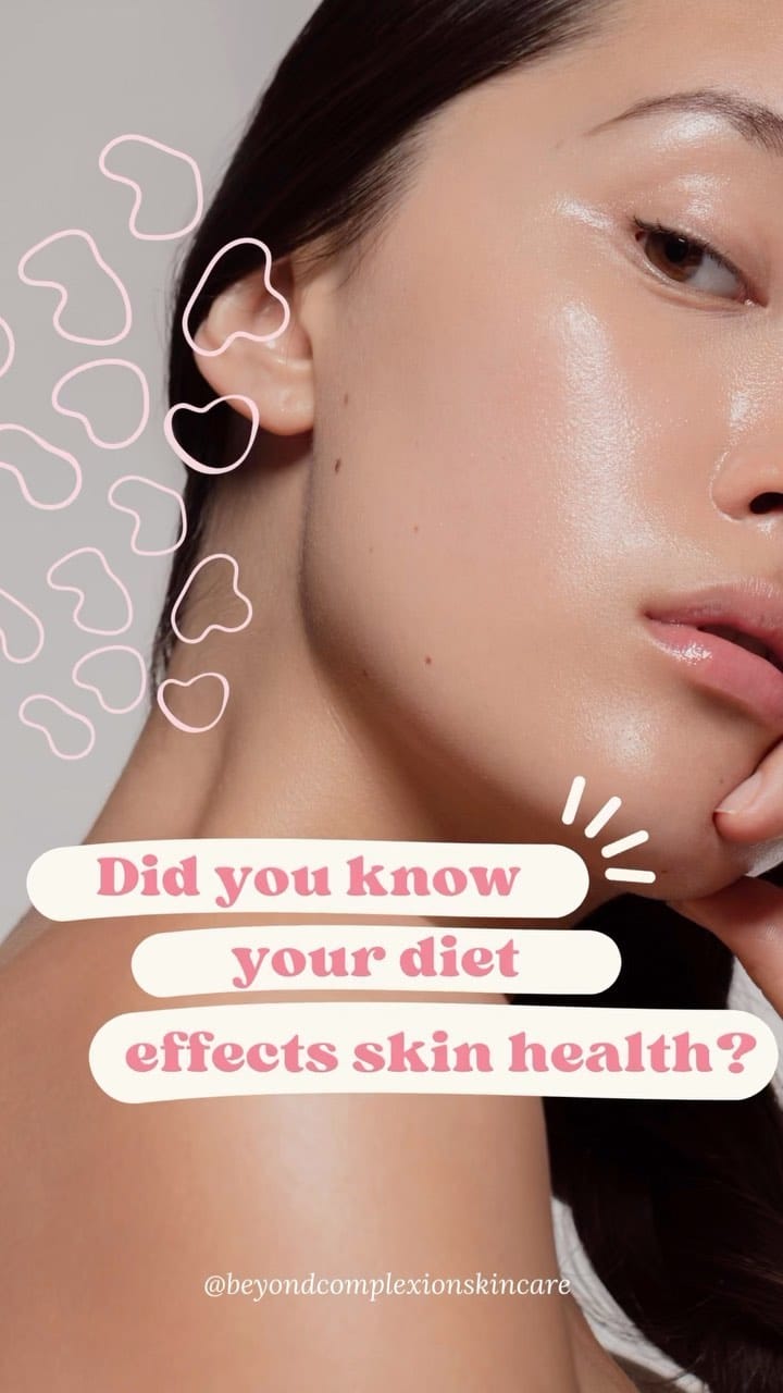 Post 8 by beyond complexion on Instagram (video)