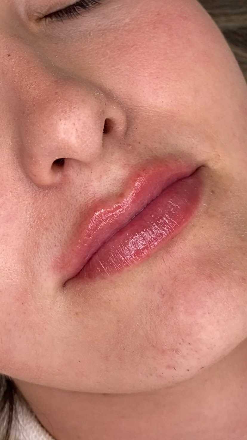 Post 9 by Clinica de Medicina Estética en Ibiza y Castellón on Instagram (video)