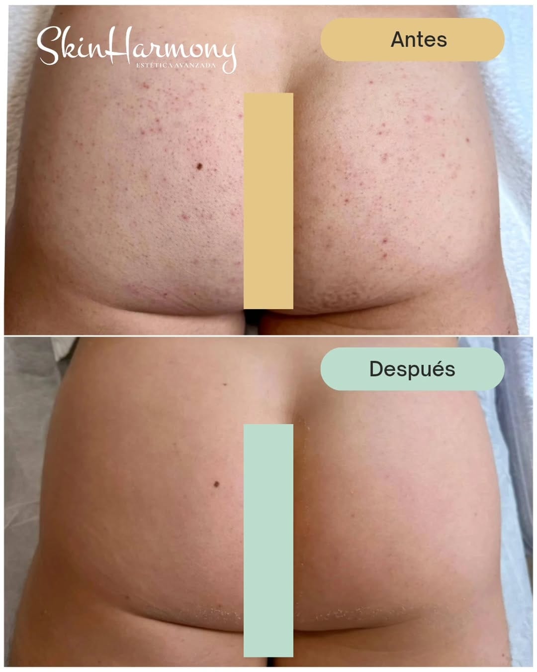 Post 2 by Skin Harmony Estetica Avanzada on Instagram (image)