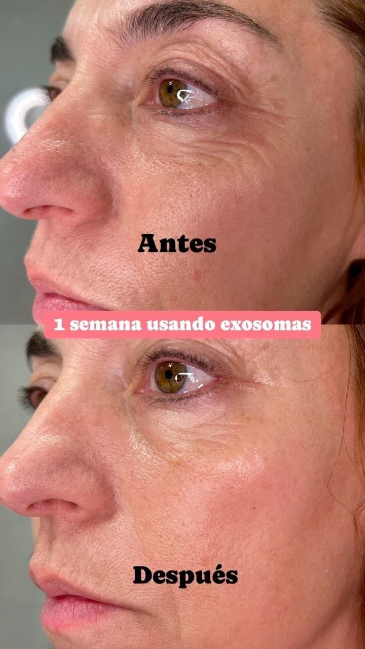 Post 10 by • PLANET SKIN • on Instagram (video)