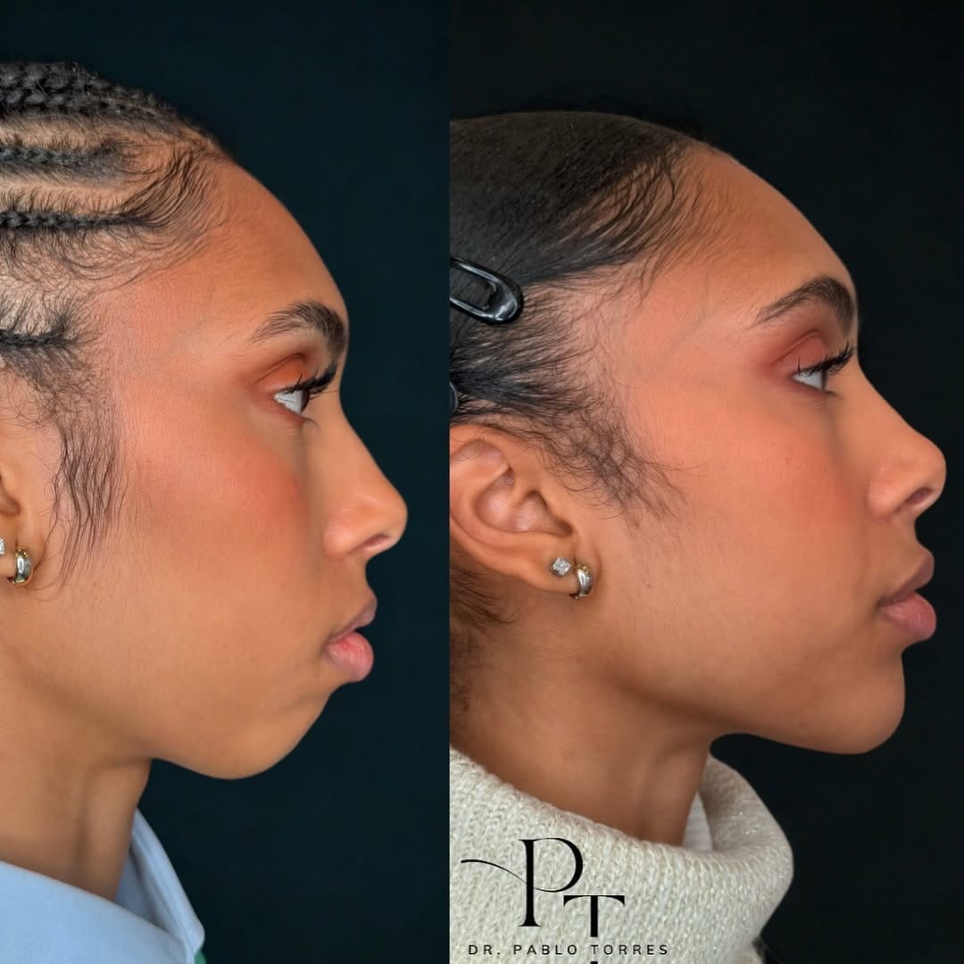 Post 7 by 𝗗𝗿. 𝗣𝗮𝗯𝗹𝗼 𝗧𝗼𝗿𝗿𝗲𝘀 on Instagram (carousel)