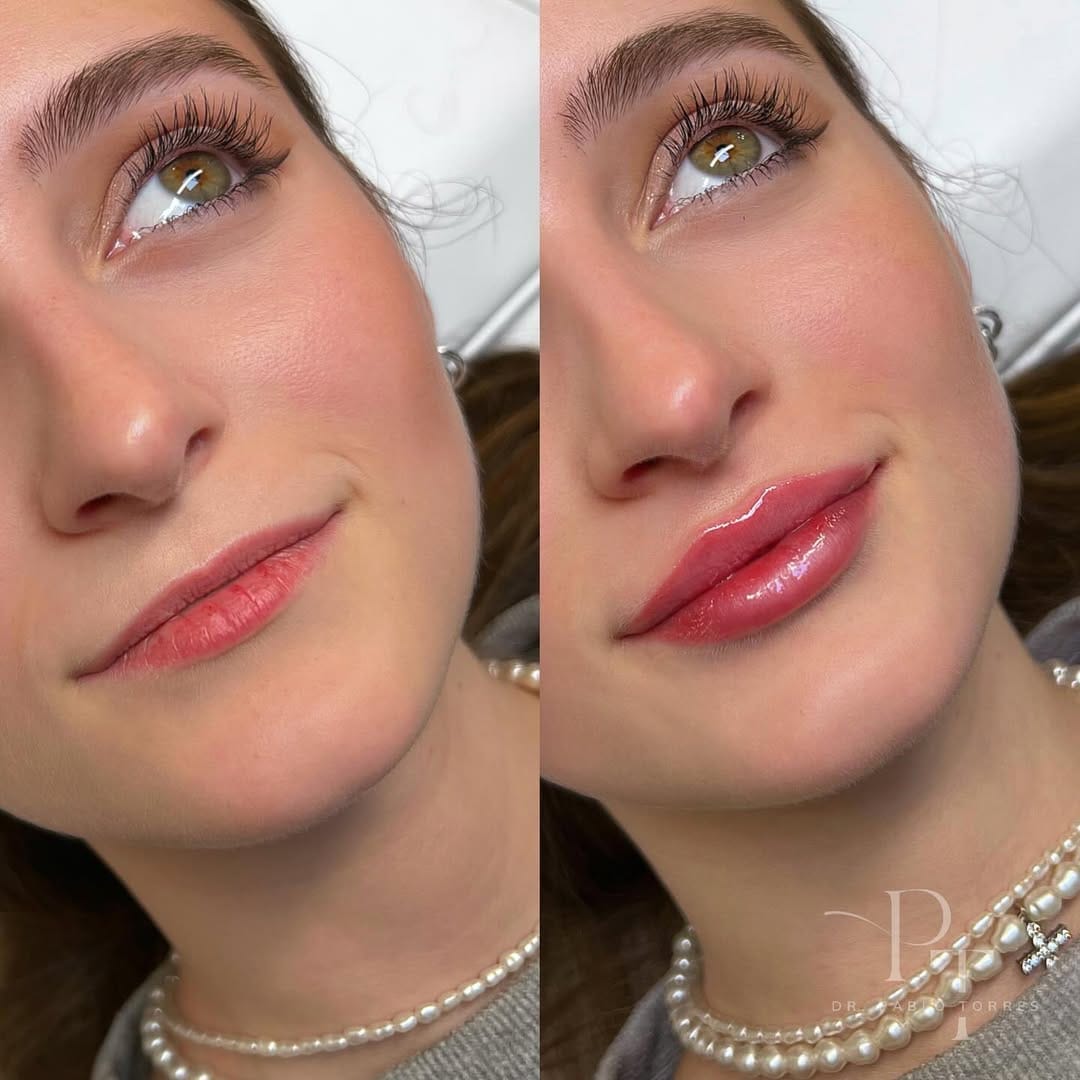 Post 9 by 𝗗𝗿. 𝗣𝗮𝗯𝗹𝗼 𝗧𝗼𝗿𝗿𝗲𝘀 on Instagram (carousel)