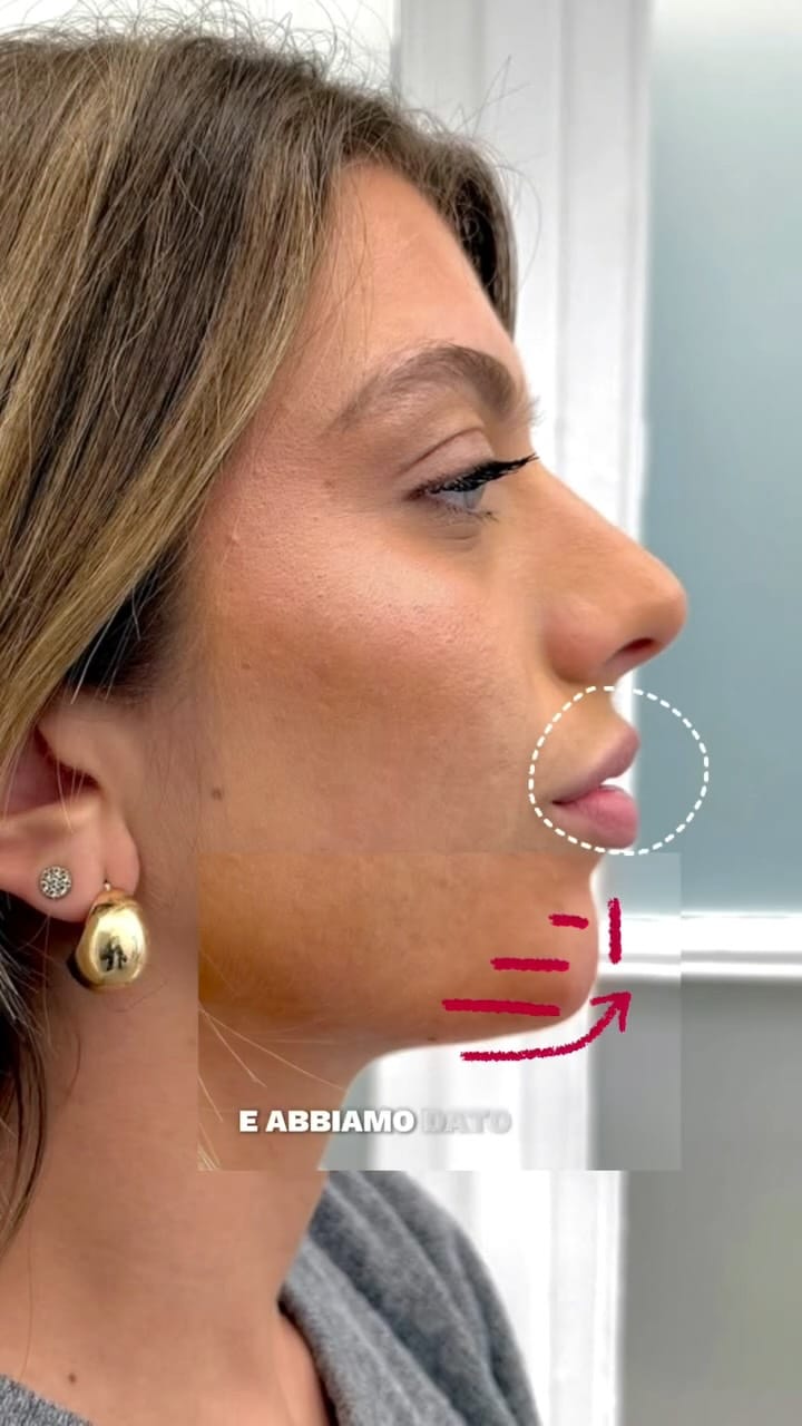 Post 5 by 𝗗𝗿. 𝗣𝗮𝗯𝗹𝗼 𝗧𝗼𝗿𝗿𝗲𝘀 on Instagram (video)