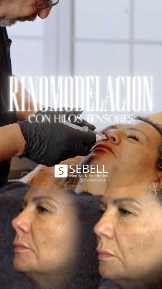 Post 2 by Clínica Sebell Barcelona on Instagram (video)