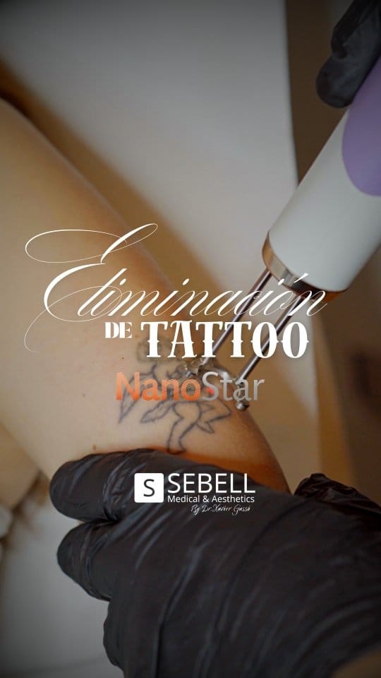 Post 8 by Clínica Sebell Barcelona on Instagram (video)