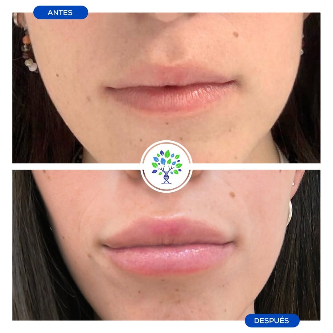 Post 4 by Clínicas Revitae del Doctor Oyola on Instagram (carousel)