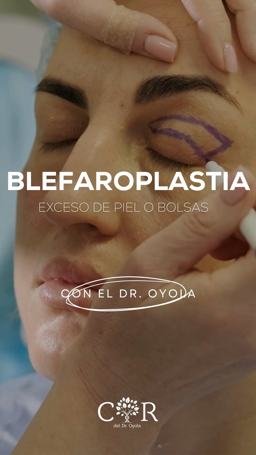 Post 6 by Clínicas Revitae del Doctor Oyola on Instagram (video)