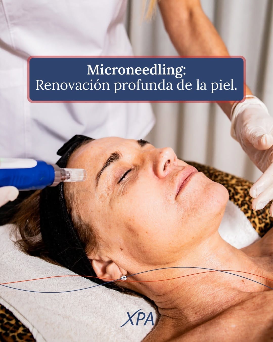 Post 2 by Xpa Medicina Estetica & Orthomolecular on Instagram (carousel)