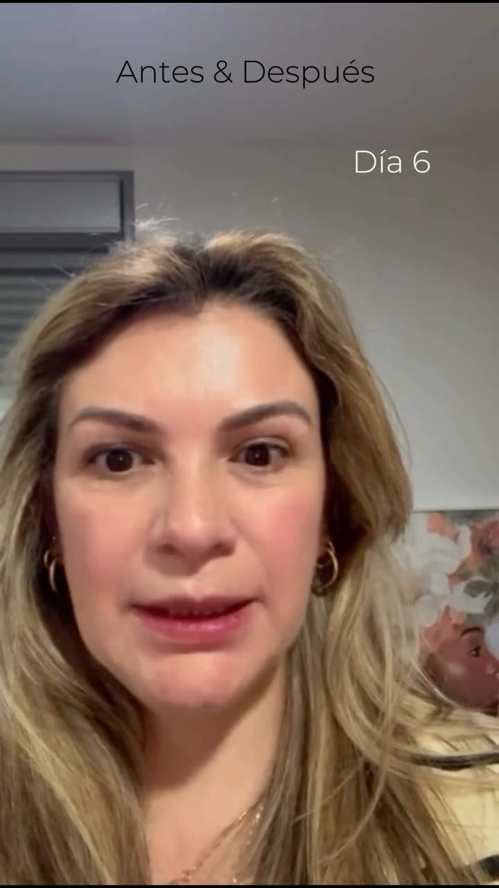 Post 3 by Dra Paula Miranda. on Instagram (video)