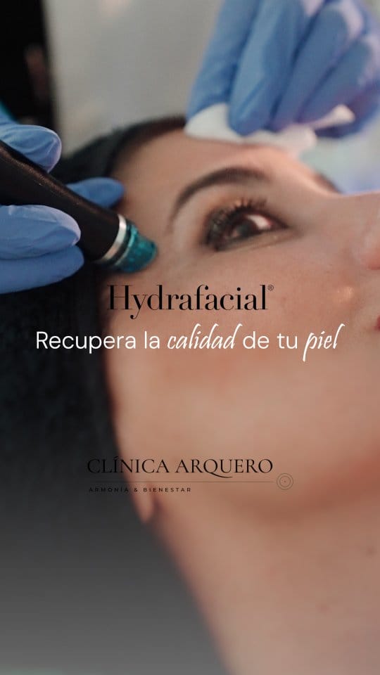 Post 9 by Clínica Arquero on Instagram (video)