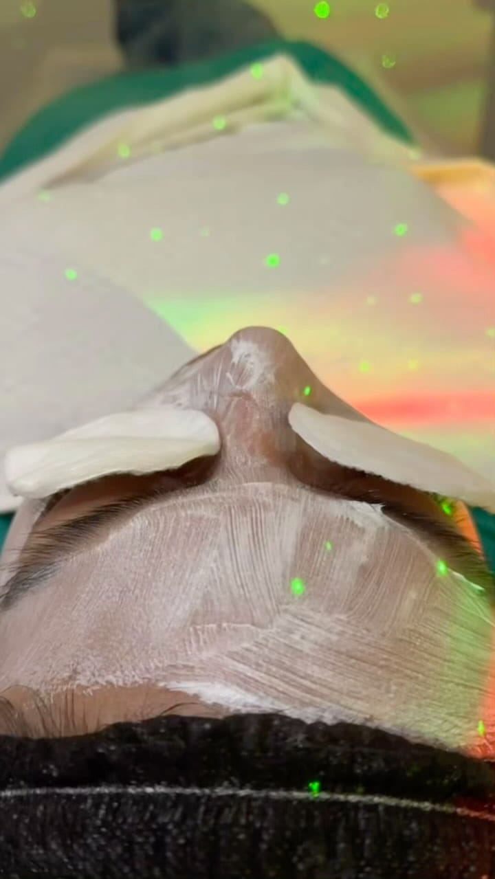 Post 5 by 𝐘𝐎𝐀 𝐂𝐄𝐋𝐄𝐒𝐓𝐄 | CENTRO DE ESTÉTICA MADRID on Instagram (video)