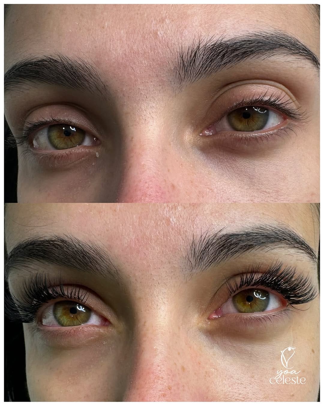 Post 3 by 𝐘𝐎𝐀 𝐂𝐄𝐋𝐄𝐒𝐓𝐄 | CENTRO DE ESTÉTICA MADRID on Instagram (carousel)