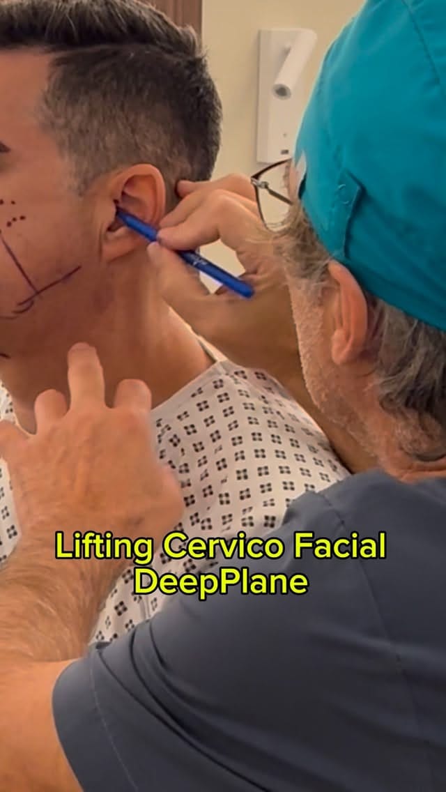 Post 8 by Doctor Mauricio Verbauvede on Instagram (video)