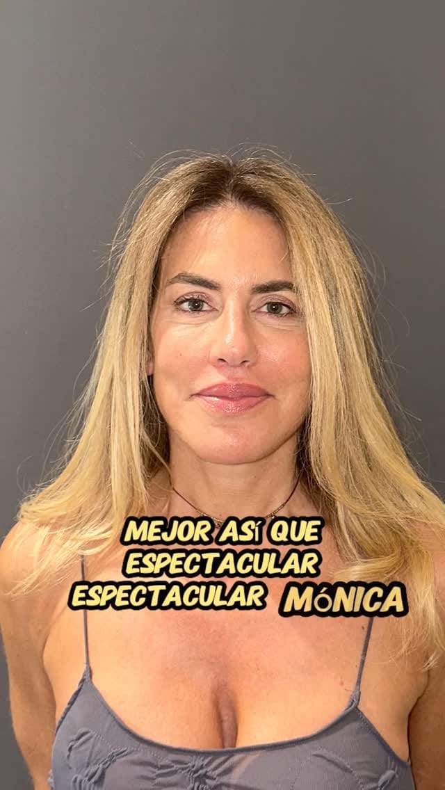 Post 10 by Doctor Mauricio Verbauvede on Instagram (video)