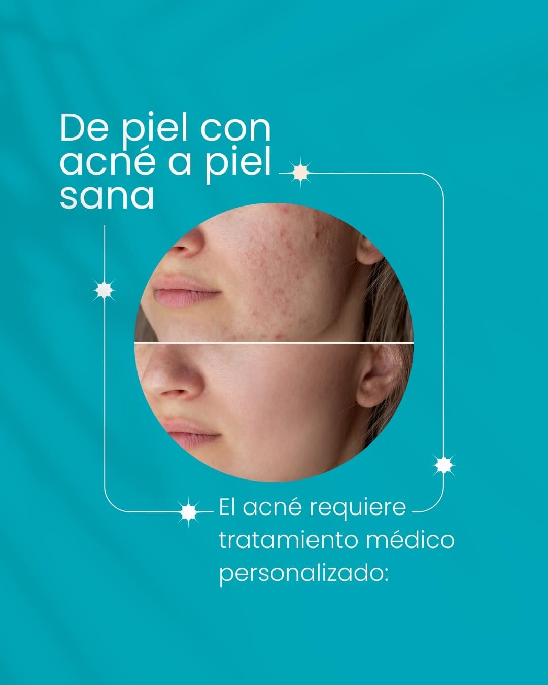 Post 7 by Clínica Dermatológica Arosemena on Instagram (carousel)