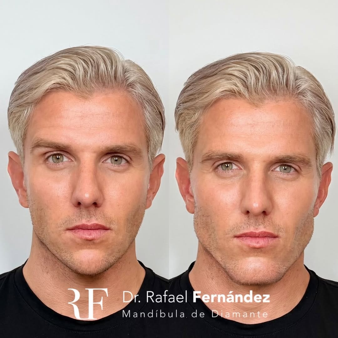 Post 3 by Creador técnica Mandíbula de Diamante on Instagram (carousel)