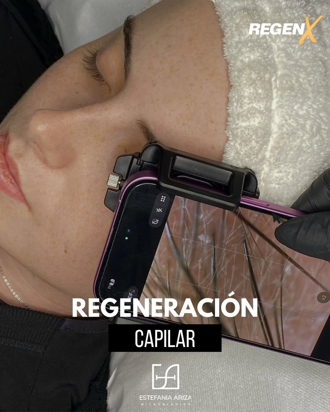 Post 7 by Estefanía Ariza Microblading Madrid on Instagram (image)