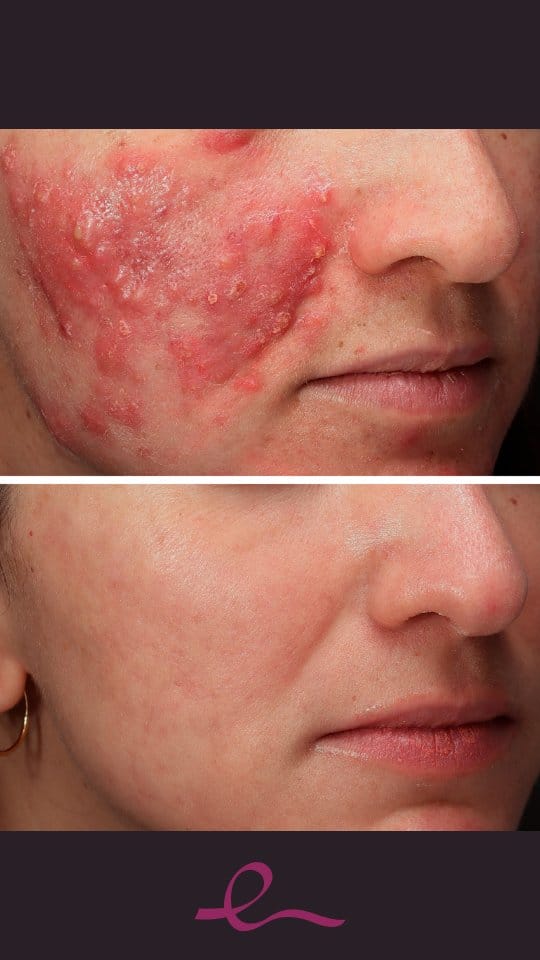 Post 1 by Clínica Eguren Dermatología on Instagram (video)