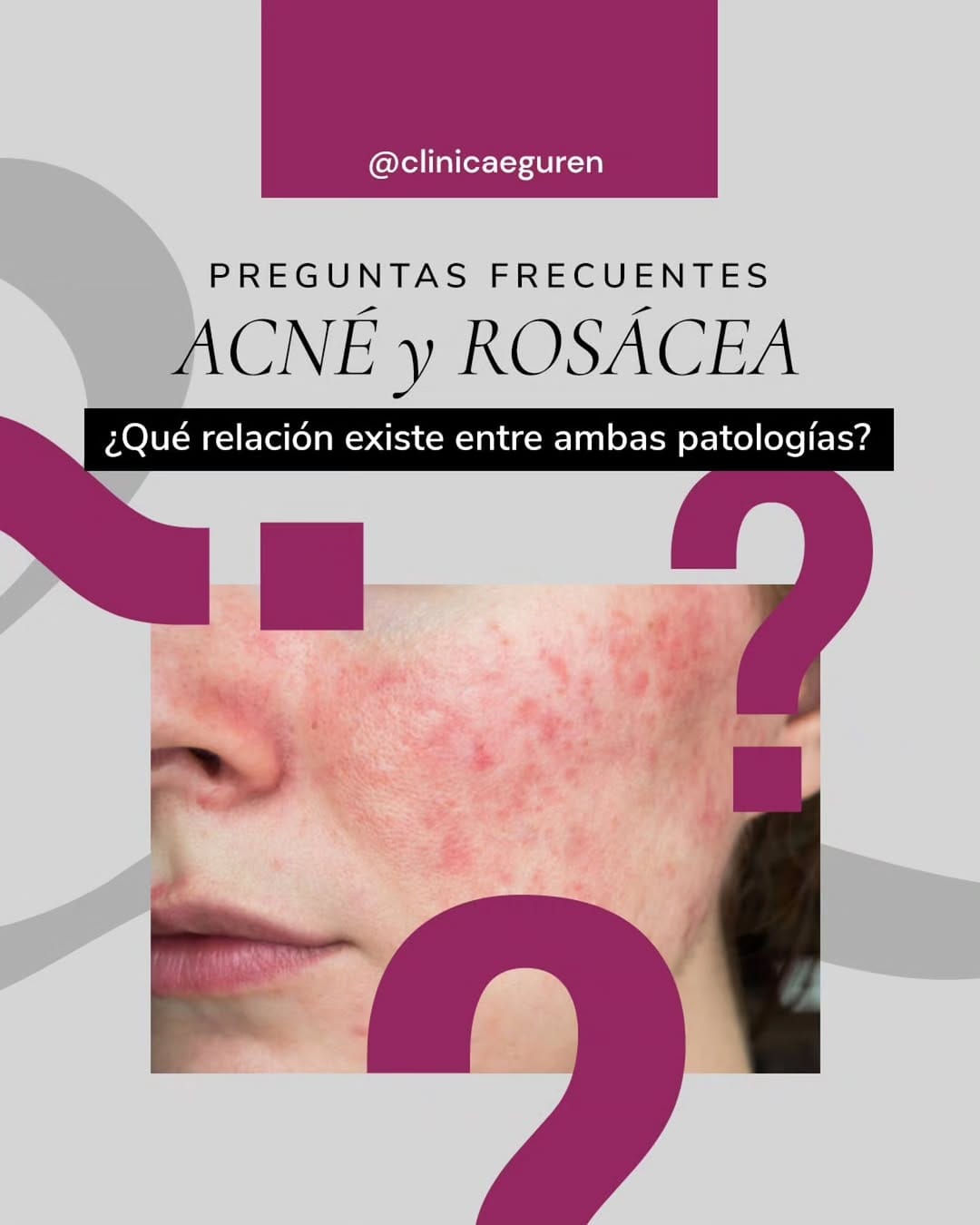 Post 2 by Clínica Eguren Dermatología on Instagram (carousel)