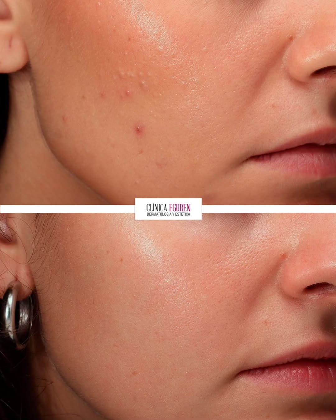 Post 3 by Clínica Eguren Dermatología on Instagram (carousel)