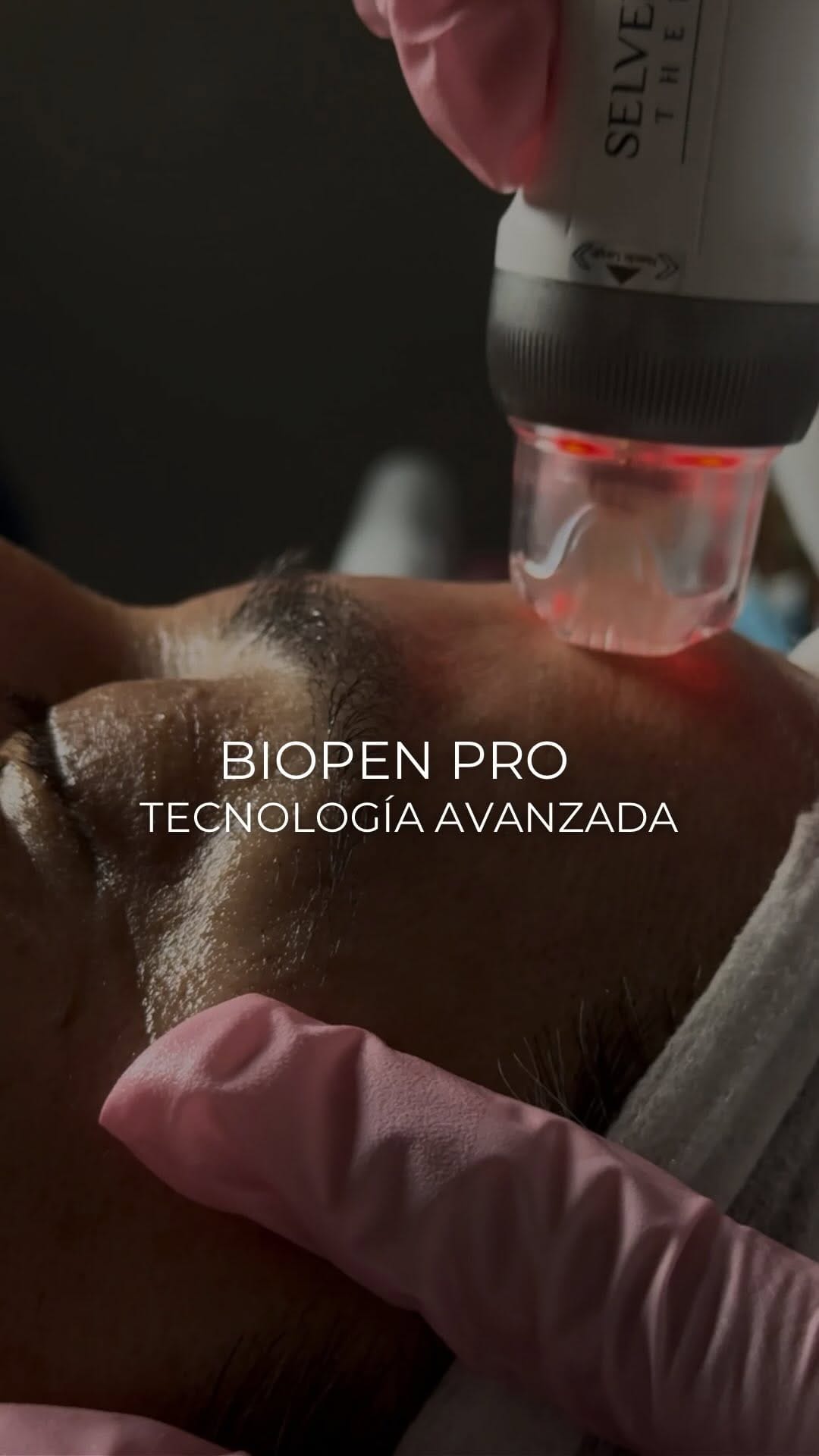 Post 1 by Clínica Esmera | Medicina Estética Madrid on Instagram (video)