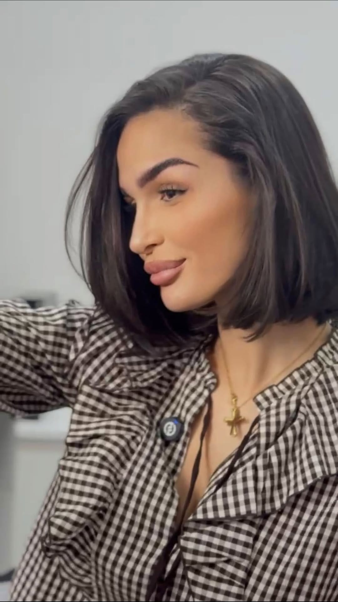 Post 9 by Clínica Esmera | Medicina Estética Madrid on Instagram (video)